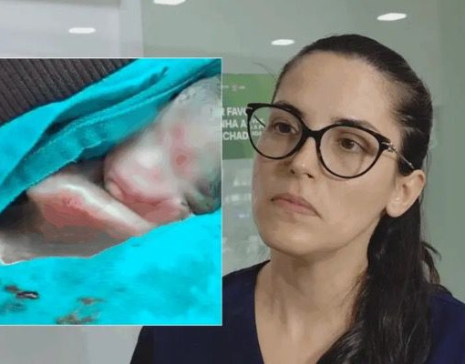 Prematuro de cinco meses surpreende médicos ao voltar a respirar no Acre