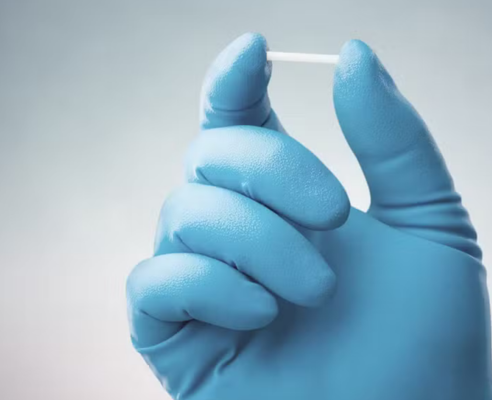 Teresina passa a oferecer chip anticoncepcional gratuito em Unidades Básicas de Saúde