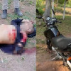 Motociclista fica ferido em forte colisão com caçamba na estrada da Cacimba Velha