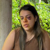 Corretora agredida pelo marido em Teresina passa por exames e tem quadro agravado