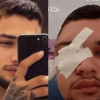 Jovem sobrevive após levar dois tiros na cabeça em ataque em Teresina