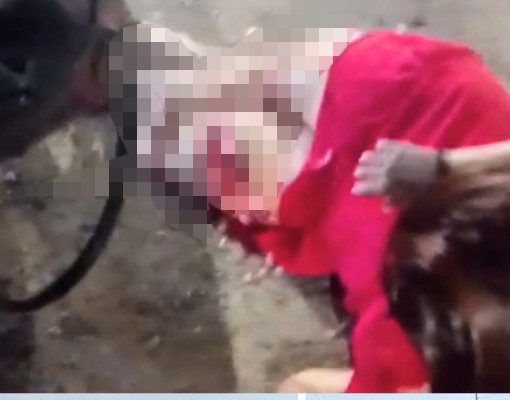 Colisão entre ônibus e motocicletas deixa mulher com fratura exposta em Teresina