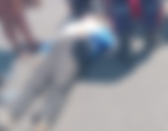 Mulher é atropelada por motocicleta e condutor foge sem prestar socorro em Teresina