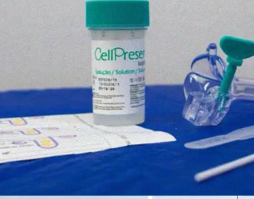 Novo teste molecular passa a ser adotado no SUS para prevenir câncer