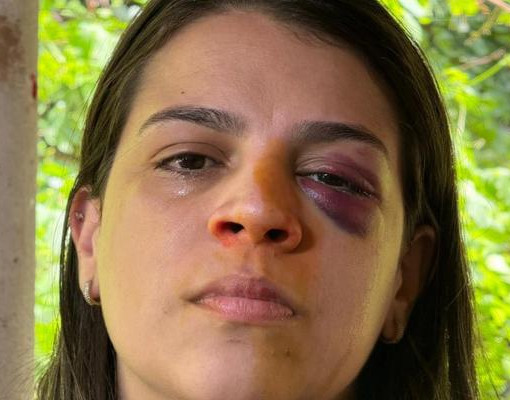 “Tenho medo de morrer”, diz mulher agredida pelo marido na zona sudeste de Teresina