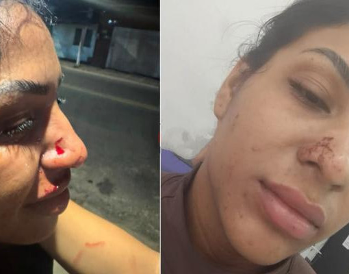 Após publicar denúncias contra ex, influencer relata agressões em Teresina: “planejou tudo”