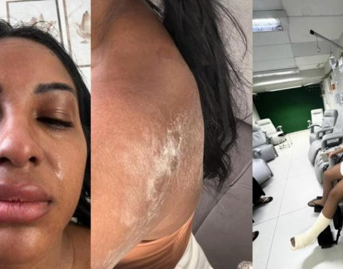 Polícia apura se agressão contra influenciadora foi tentativa de feminicídio