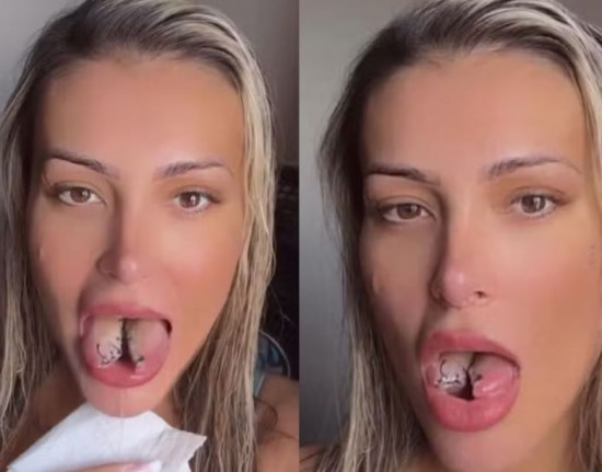 Andressa Urach cogita implante de terceiro seio após bifurcação na língua