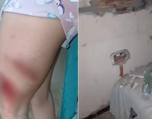 Mulher é atingida por raio dentro de casa durante chuva em Buriti dos Lopes