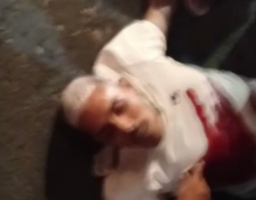 Homem é baleado e morre após ser levado ao Hospital do Dirceu, em Teresina