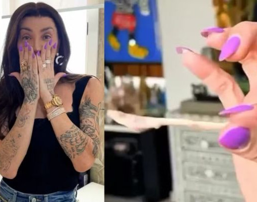 Maya Massafera mostra resultado de cirurgia no maxilar e alerta sobre inchaço: “Não se assustem”