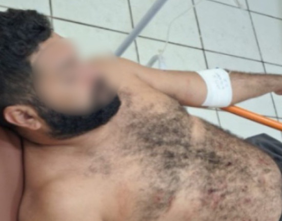 Suspeito de stalking é baleado após discussão com companheiro da vítima