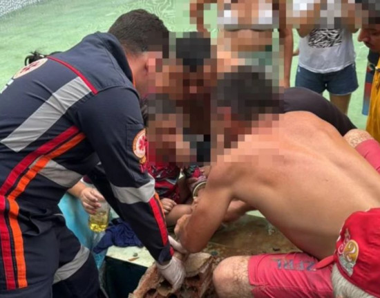 Criança é resgatada após ficar com o braço preso na boquilha de piscina em Cocal