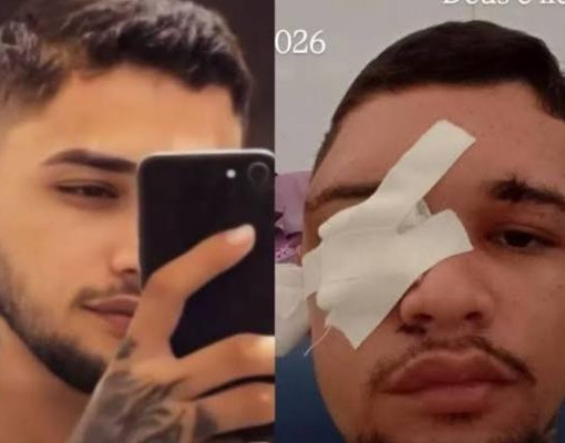 Jovem sobrevive após levar dois tiros na cabeça em ataque em Teresina