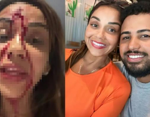 Cantora Walkiria Estarley denuncia agressão e aparece ferida durante live