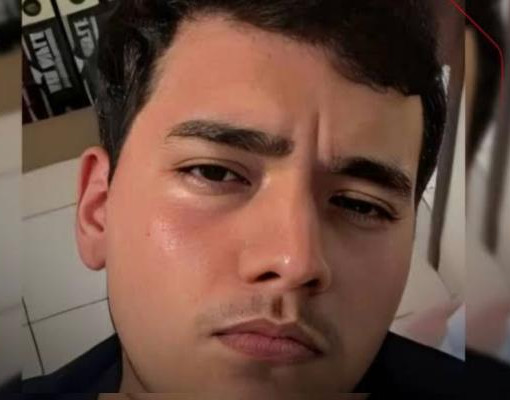 Estudante de Direito morre após colisão entre moto e carro na BR-316 em Picos