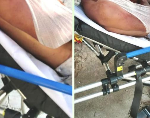 Dois suspeitos invadem residência e deixam homem gravemente ferido no Piauí