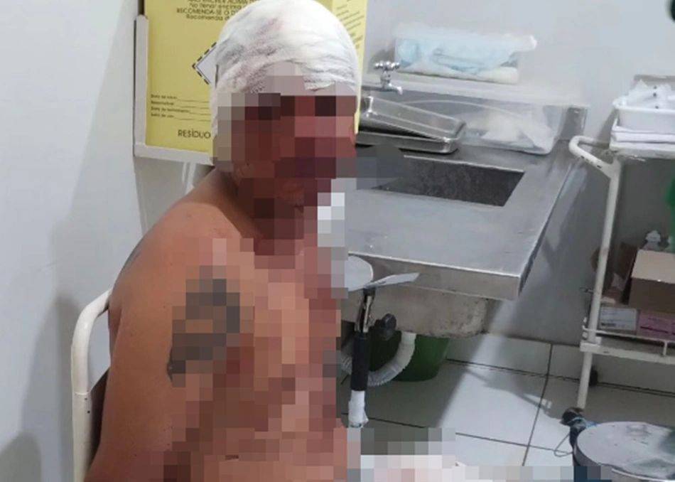 Homem é espancado após agredir ex-mulher no Piauí