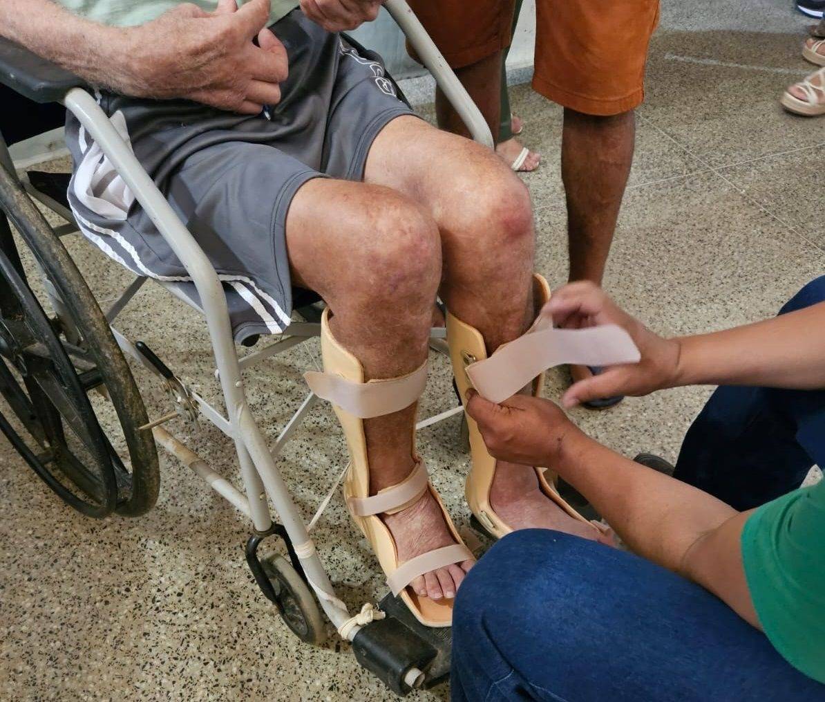 Sesapi entrega 1.610 órteses, próteses e outros equipamentos na região da Serra da Capivara