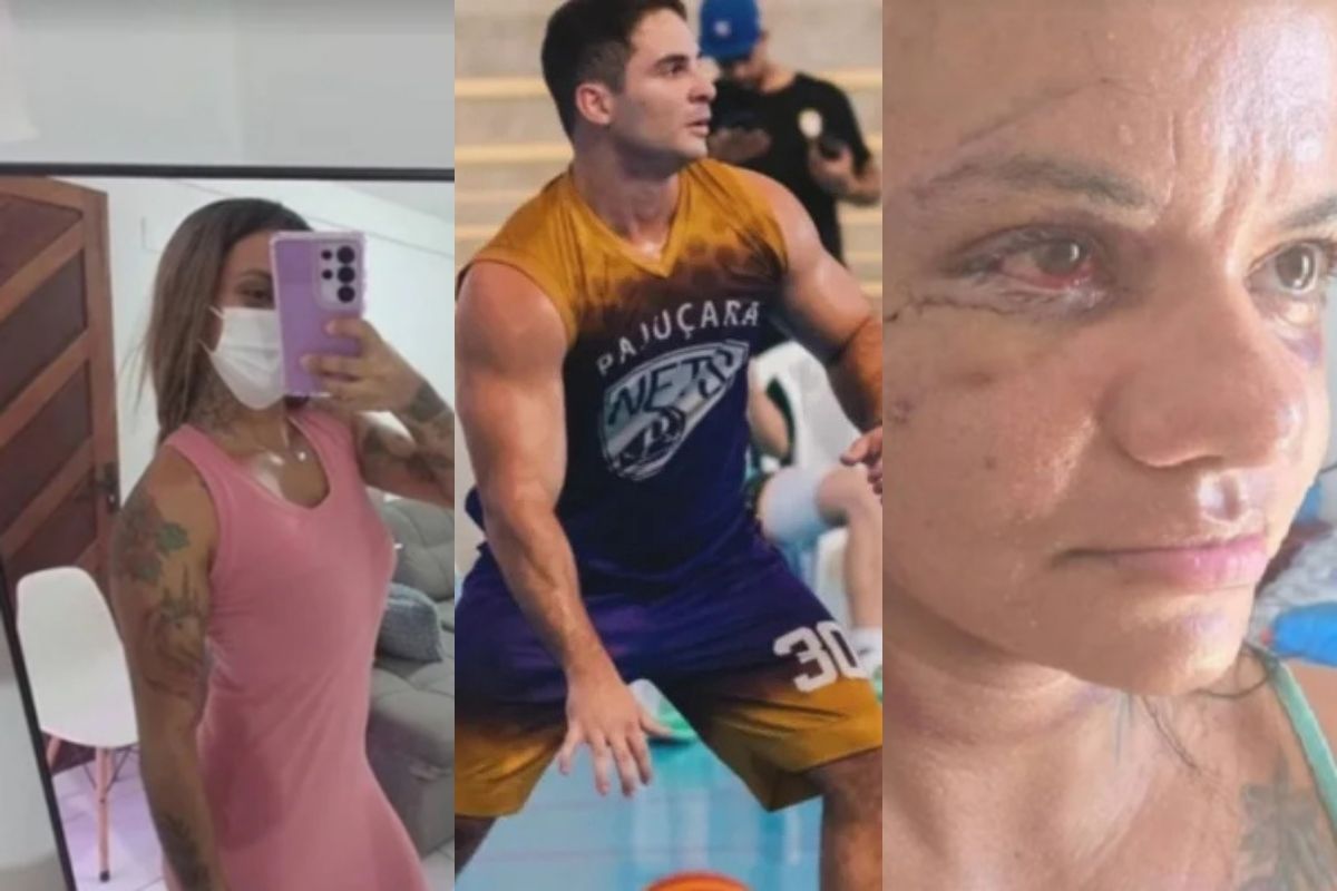 Após levar 61 socos em elevador, Juliana Garcia mostra recuperação nas redes sociais