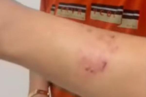 Suspeito de tráfico reage à prisão e fere policial com mordida na zona Sul de Teresina