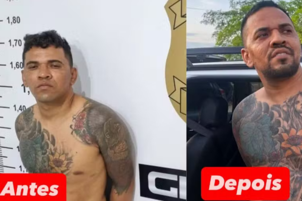 Suspeito de liderar facção fazia plásticas para enganar a polícia no Piauí
