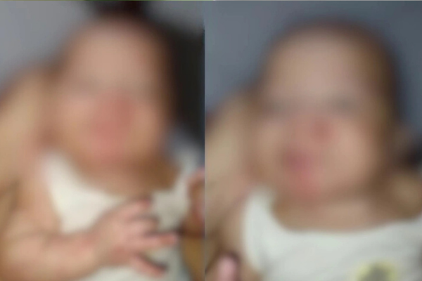 Supostas agressões a bebê levantam investigação do Conselho Tutelar em Teresina