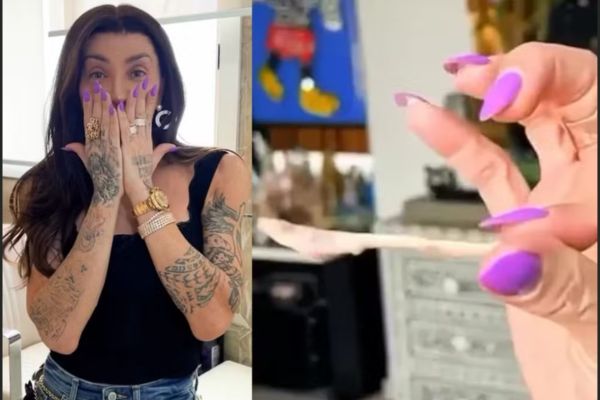 Maya Massafera mostra resultado de cirurgia no maxilar e alerta sobre inchaço: “Não se assustem”